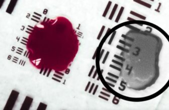 This Experimental Tech Permits Surgeons to See By Blood