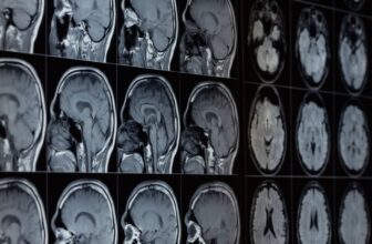 Our Brains Comprise Lithium—and Its Loss May Assist Drive Alzheimer’s, Research Finds